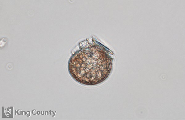 Photo of Dinophysis parva